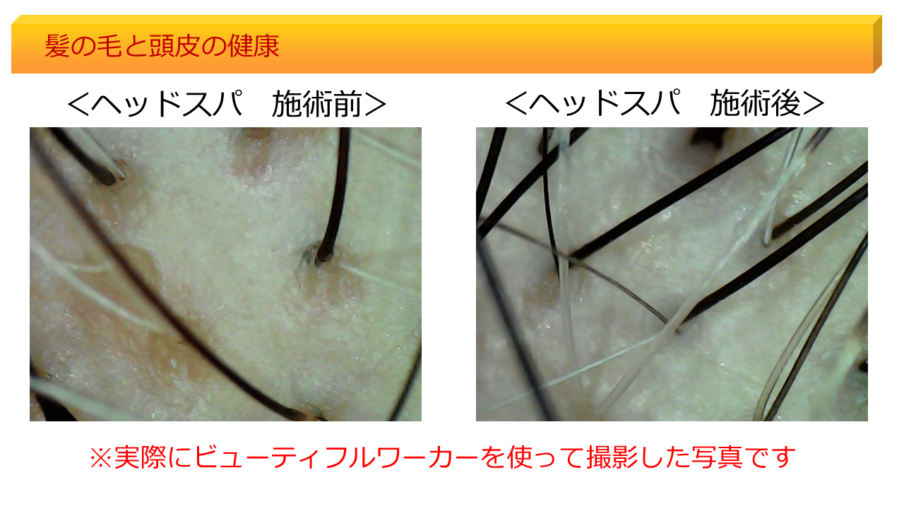 ビューティフルワーカーの髪の毛と頭皮の健康